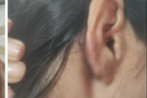 Manipur Woman and Friend Allegedly Assaulted in Delhi