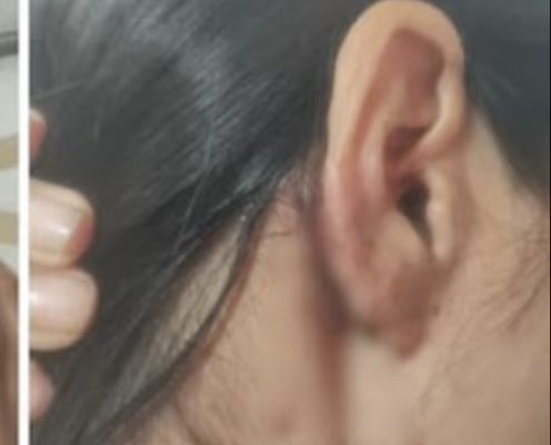 Manipur Woman and Friend Allegedly Assaulted in Delhi