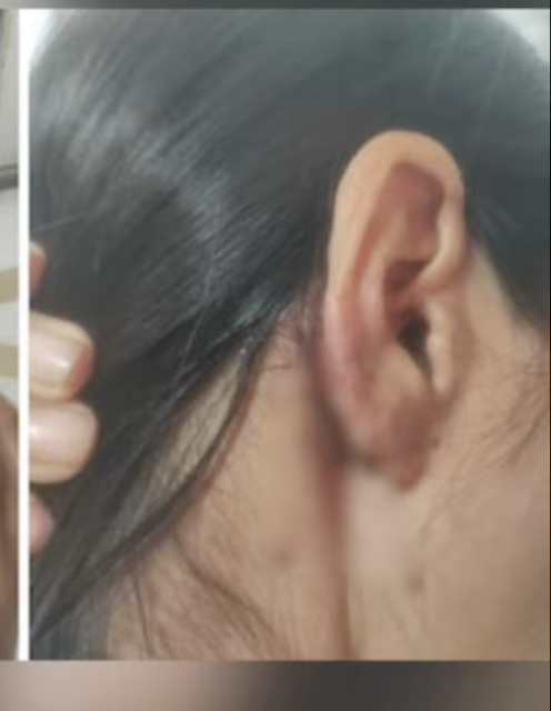 Manipur Woman and Friend Allegedly Assaulted in Delhi